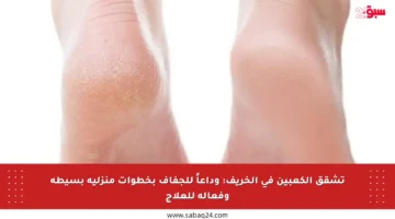 تشقق الكعبين في الخريف: وداعاً للجفاف بخطوات منزلية بسيطة وفعالة للعلاج